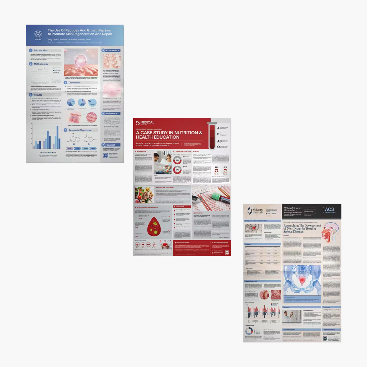 19 Research Poster Template Bundle | Academic Scientific Medical Research Case Study Poster Templates | Adobe Indesign